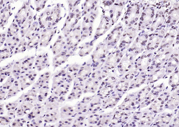 SIK1 Rabbit Polyclonal Antibody