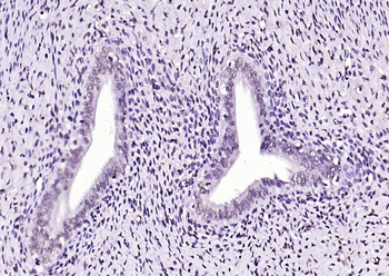 SIK1 Rabbit Polyclonal Antibody