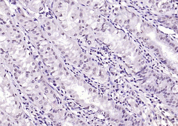 SIK1 Rabbit Polyclonal Antibody