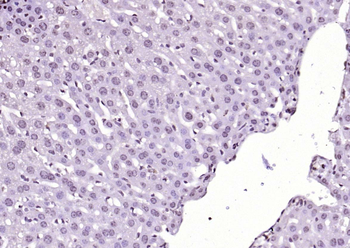 SIK1 Rabbit Polyclonal Antibody