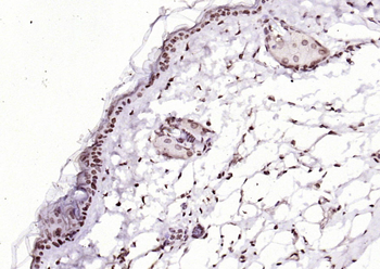 SIK1 Rabbit Polyclonal Antibody