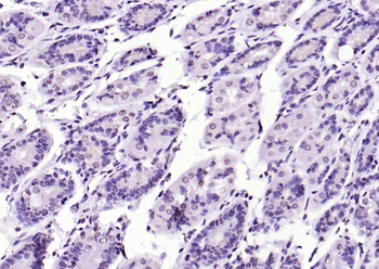 SIK1 Rabbit Polyclonal Antibody