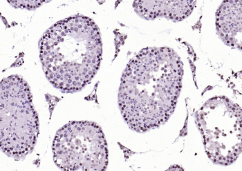 SIK1 Rabbit Polyclonal Antibody