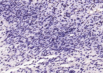 SIK1 Rabbit Polyclonal Antibody