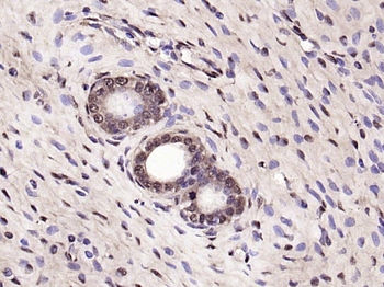 DUSP3 Rabbit Polyclonal Antibody