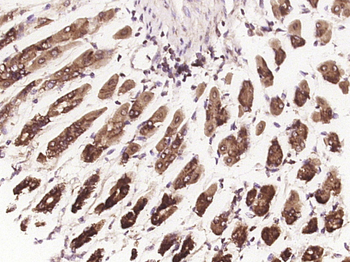 Phospho-Vinculin (Tyr822) Rabbit Polyclonal Antibody
