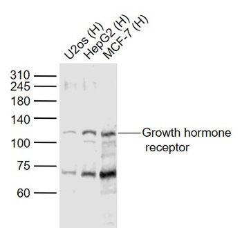 Growth hormone receptor Rabbit Polyclonal Antibody