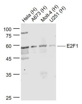 E2F1 Rabbit Polyclonal Antibody