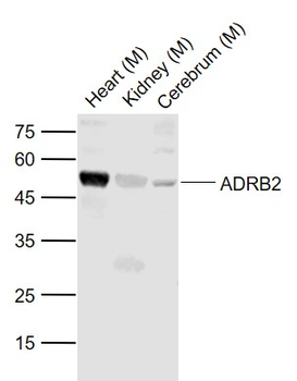 ADRB2 Rabbit Polyclonal Antibody