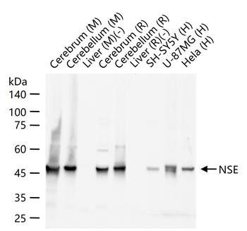 NSE Rabbit Polyclonal Antibody