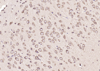 Peroxiredoxin-5 Rabbit Polyclonal Antibody