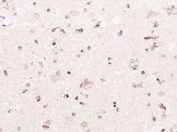 BMAL1 Rabbit Polyclonal Antibody