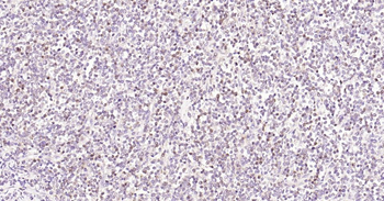 Caspase-3 Recombinant Rabbit Monoclonal Antibody