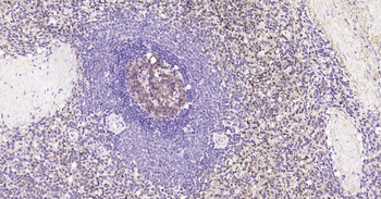 Caspase-3 Recombinant Rabbit Monoclonal Antibody