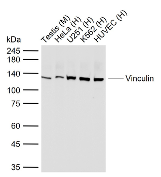 Vinculin Recombinant Rabbit Monoclonal Antibody (Loading Control)