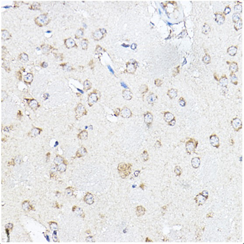 SCD Rabbit Polyclonal Antibody
