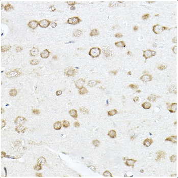 SCD Rabbit Polyclonal Antibody