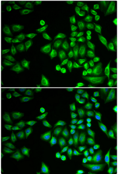 PTPN1 Rabbit Polyclonal Antibody