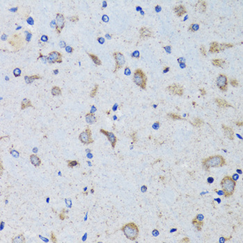 PTPN1 Rabbit Polyclonal Antibody