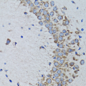 PTPN1 Rabbit Polyclonal Antibody