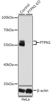 PTPN1 Rabbit Polyclonal Antibody