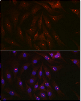 PARP1 Rabbit Polyclonal Antibody