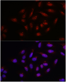 PARP1 Rabbit Polyclonal Antibody