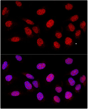 PARP1 Rabbit Polyclonal Antibody