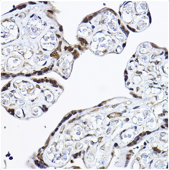 PDCD4 Rabbit Polyclonal Antibody