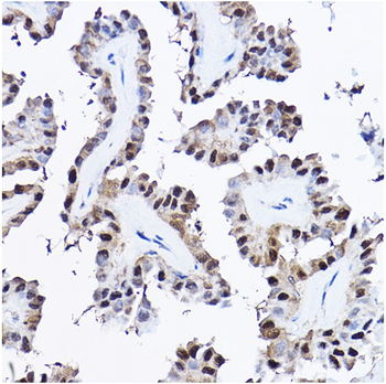 PDCD4 Rabbit Polyclonal Antibody