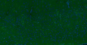 CD34 Recombinant Rabbit Monoclonal Antibody