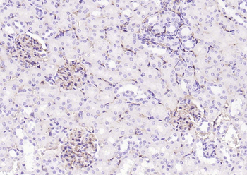 CD34 Recombinant Rabbit Monoclonal Antibody