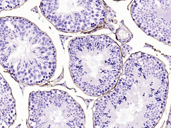 CD34 Recombinant Rabbit Monoclonal Antibody