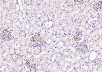 CD34 Recombinant Rabbit Monoclonal Antibody