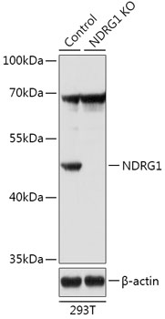 NDRG1 Rabbit Polyclonal Antibody