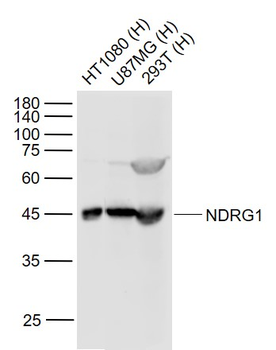 NDRG1 Rabbit Polyclonal Antibody