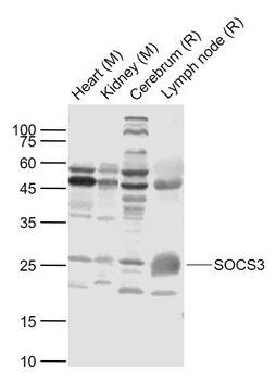 SOCS3 Rabbit Polyclonal Antibody