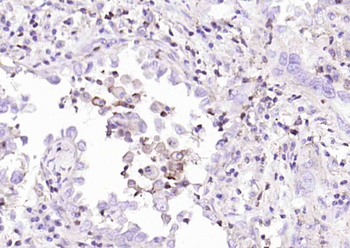PD-L1 Recombinant Rabbit Monoclonal Antibody