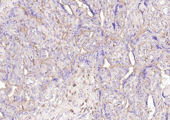 PD-L1 Recombinant Rabbit Monoclonal Antibody