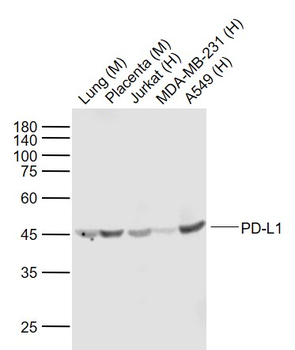 PD-L1 Recombinant Rabbit Monoclonal Antibody
