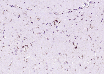 Beclin 1 Rabbit Polyclonal Antibody