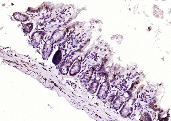 Beclin 1 Rabbit Polyclonal Antibody