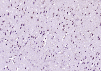 Beclin 1 Rabbit Polyclonal Antibody