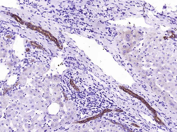 CYP26A1 Recombinant Rabbit Monoclonal Antibody