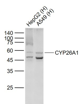 CYP26A1 Recombinant Rabbit Monoclonal Antibody