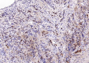 BST2 Recombinant Rabbit Monoclonal Antibody