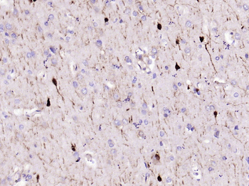 CALB2 Recombinant Rabbit Monoclonal Antibody