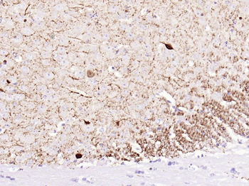 CALB2 Recombinant Rabbit Monoclonal Antibody