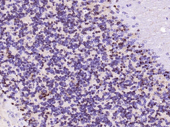 CALB2 Recombinant Rabbit Monoclonal Antibody