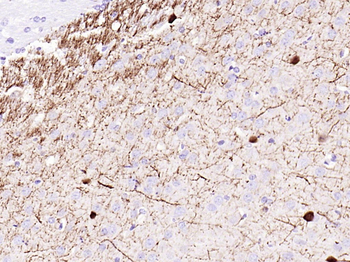 CALB2 Recombinant Rabbit Monoclonal Antibody